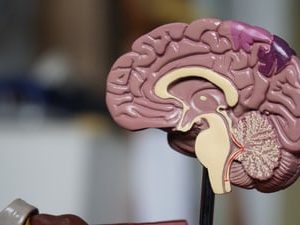 Brain Crosscut