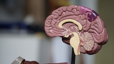 Brain Crosscut