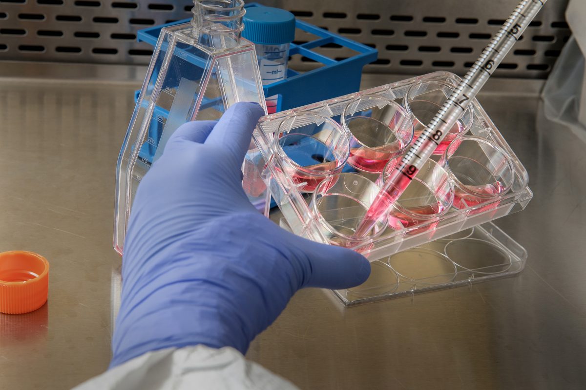 lab work
