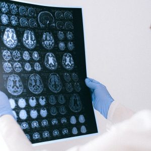 mri of brain