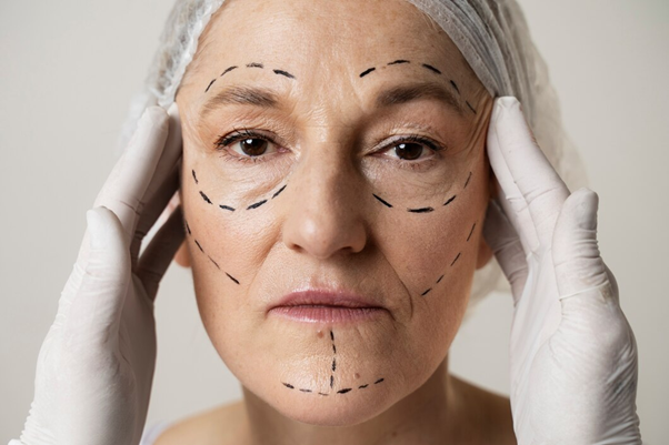 Tips for Choosing the Best Clinic for Thread Lift Procedures