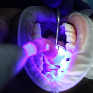 Understanding the Link Between Oral Health and Chronic Conditions