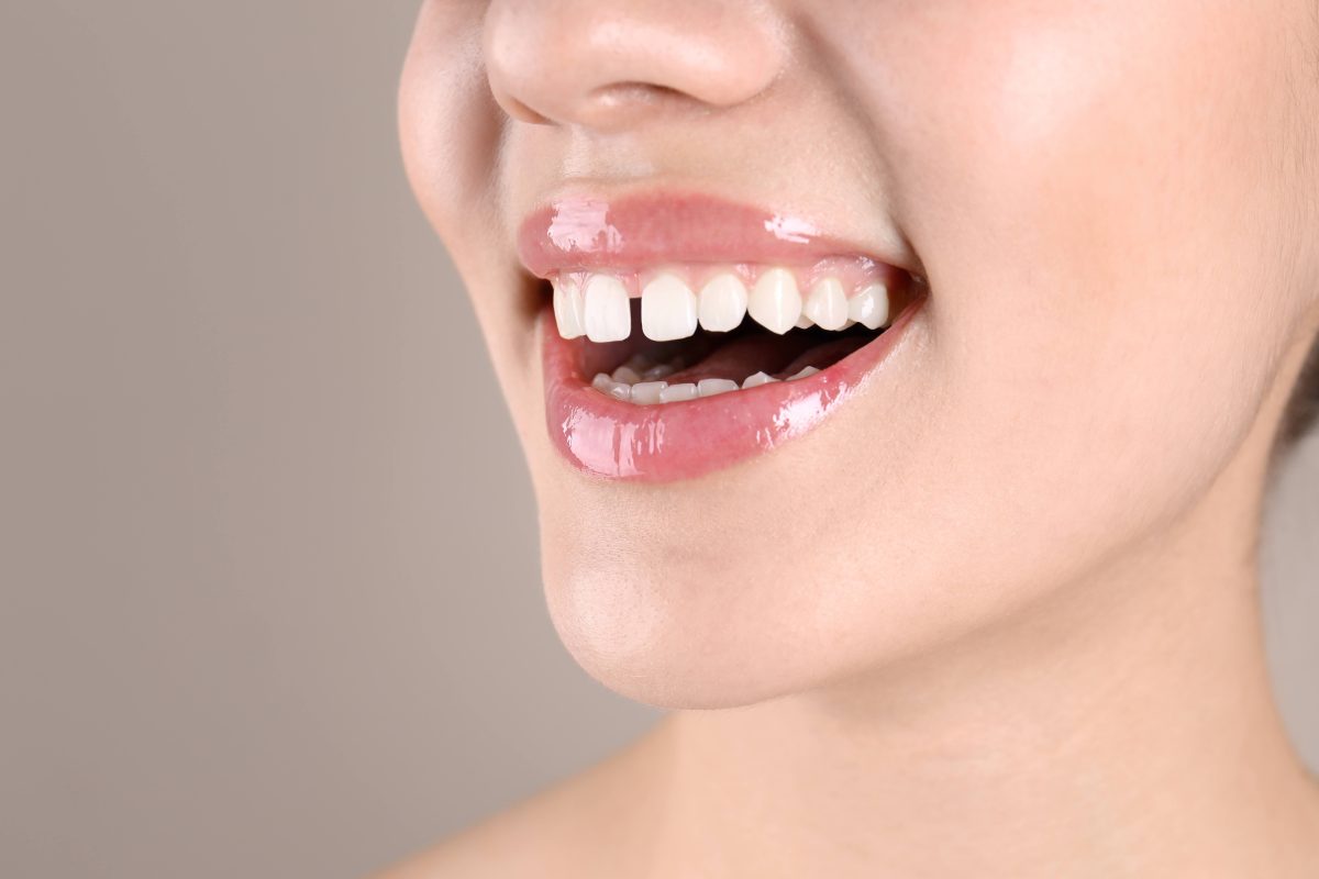 woman with front tooth gap