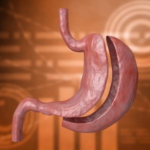photo of a model stomach that has been split in two