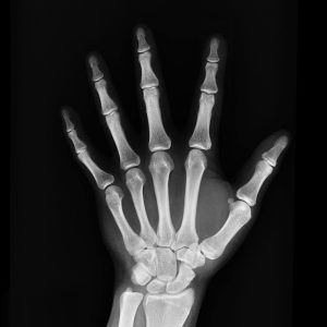 How a neuromusculoskeletal specialist can help 