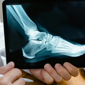Dealing With Injuries: 6 Critical Tips You Need to Follow