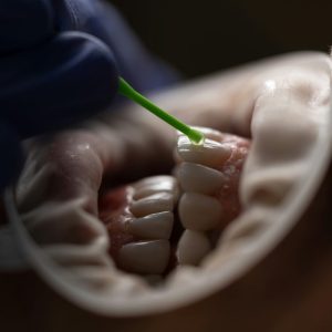 Adult Prophy Paste Selection Guide For Dental Professionals