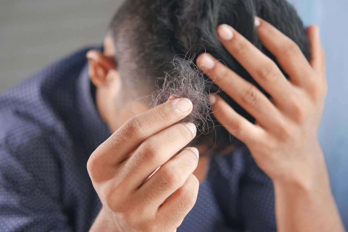 Is Hair Loss Reversible? 6 Things You Should Know