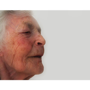 4 Key Elements of Quality Alzheimer's Care