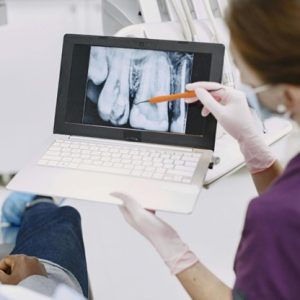 dentist showing xray of teeth on a computer to a patient