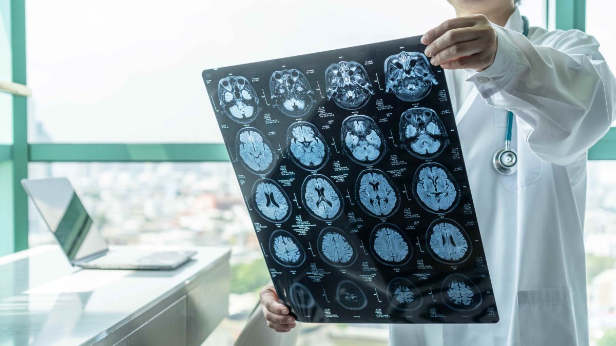 Doctor reviewing MRI brain scan