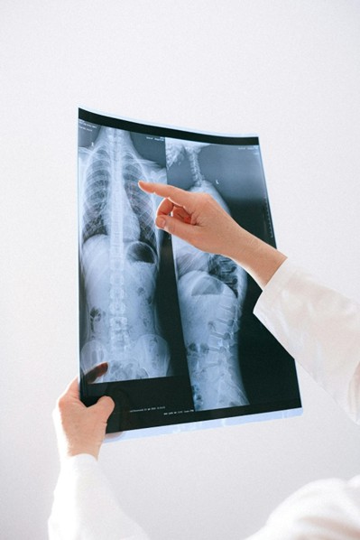 hand with white jacket pointing to a chest xray