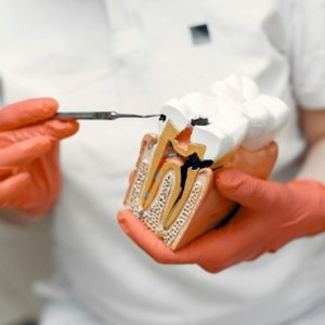 dentist pointing at a model tooth