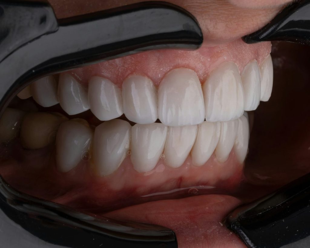a person's teeth