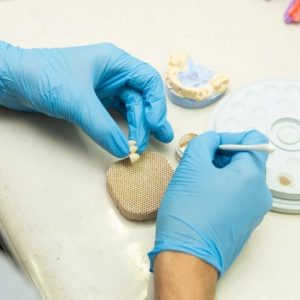 hands with gloves holding dental teeth crowns