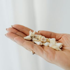 loose teeth in the palm of a hand