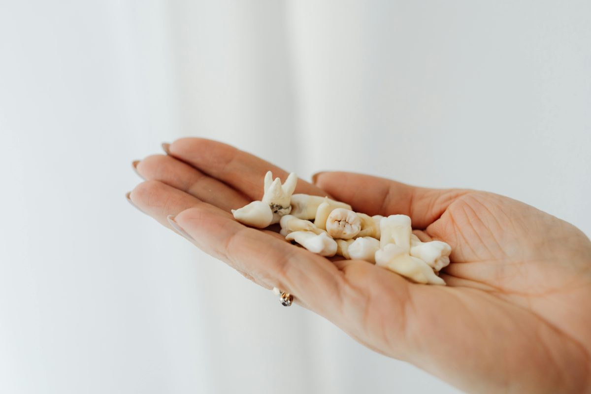loose teeth in the palm of a hand