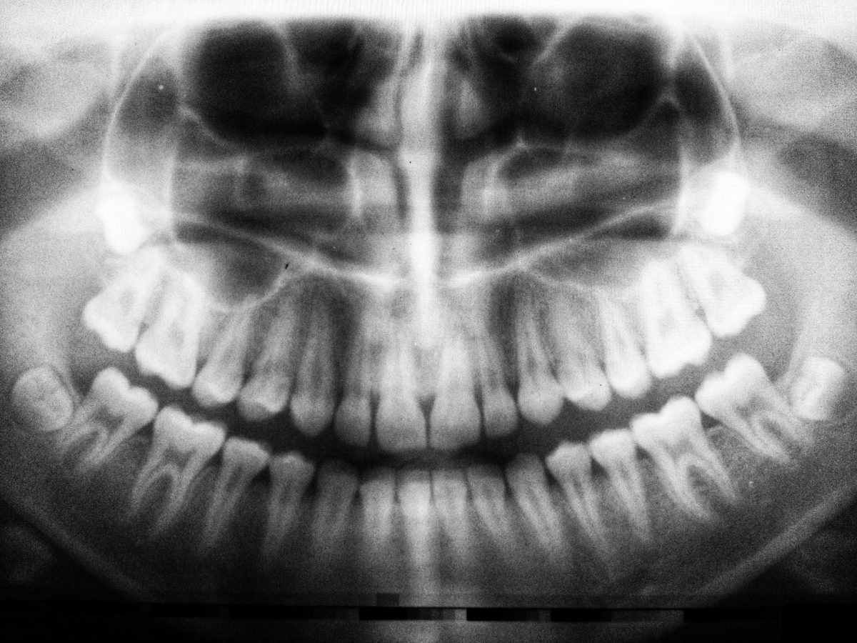 dental xray