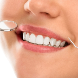 close up of a woman's smile at the dentist