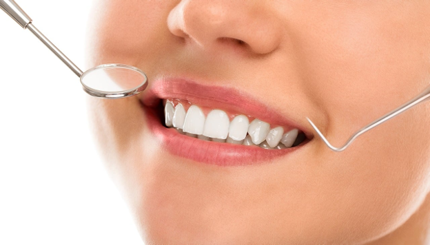 close up of a woman's smile at the dentist
